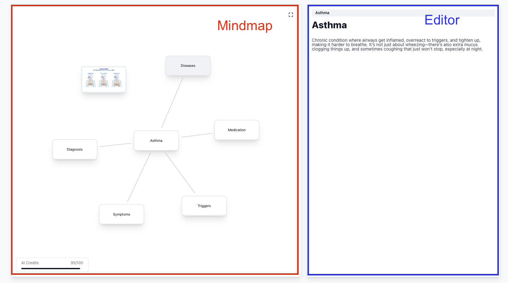 Brainstorms Demo